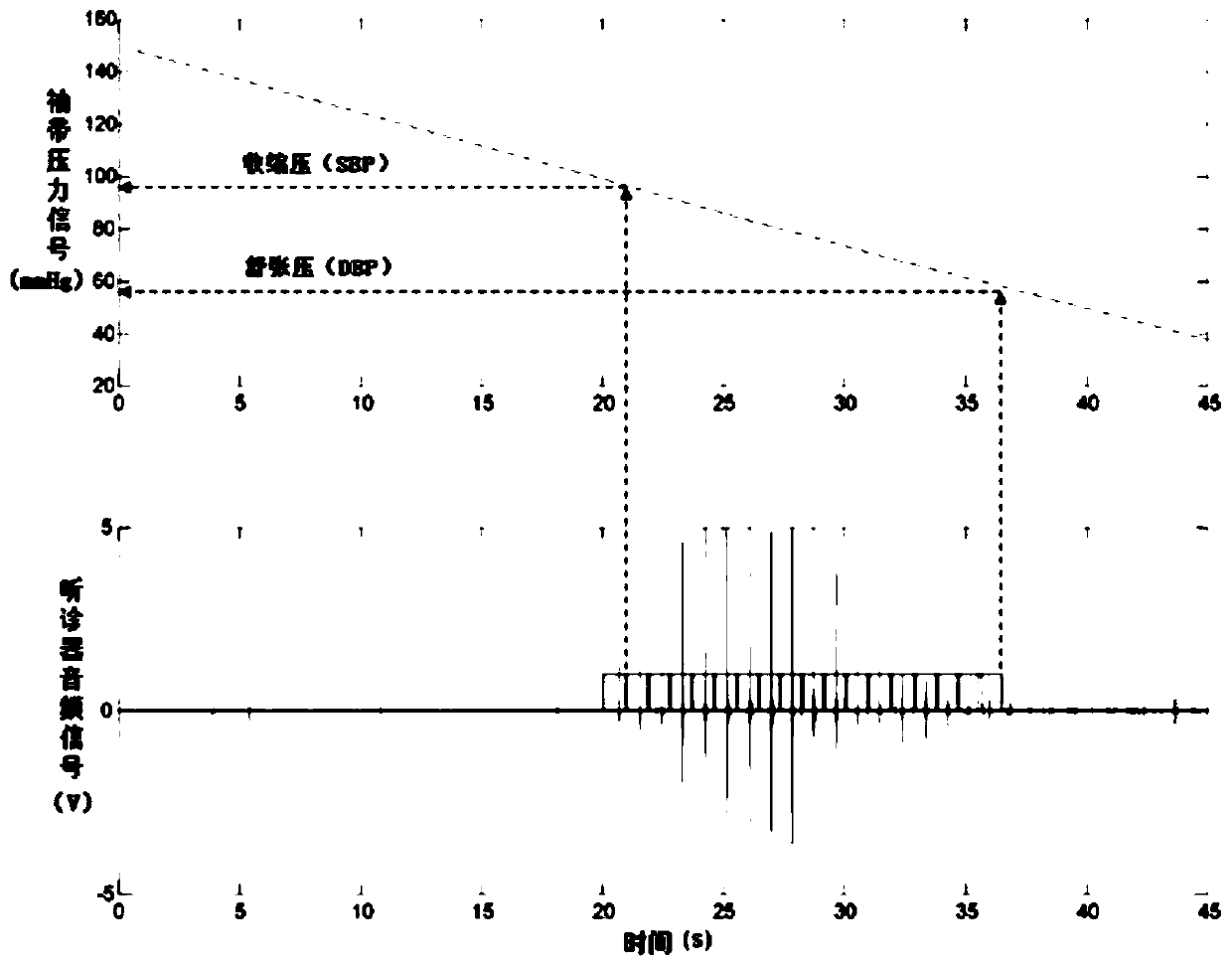 Stethoscope audio data processing method based on deep learning