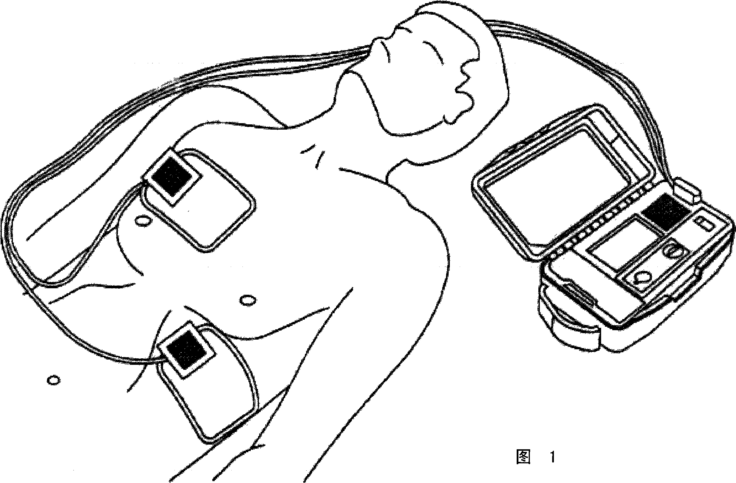 Automated external defibrillator (aed) with discrete sensing pulse for use in configuring a therapeutic biphasic waveform