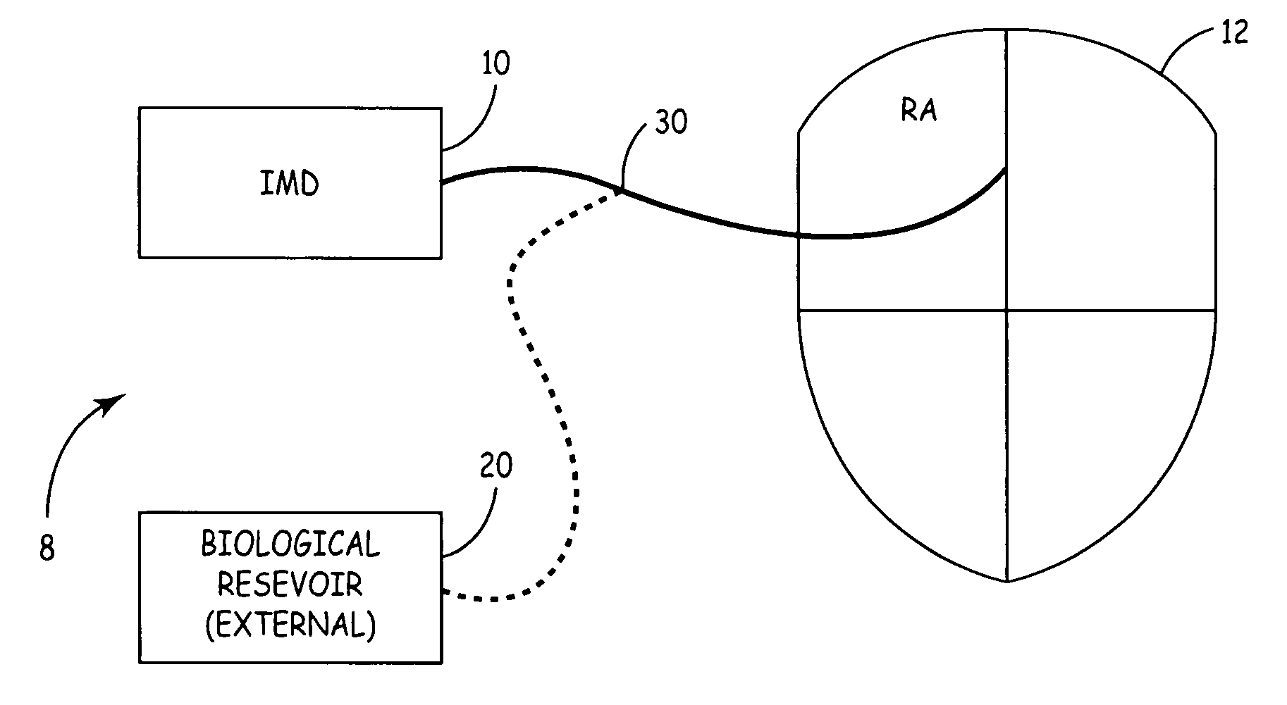 System for the delivery of a biologic therapy with device monitoring and back-up