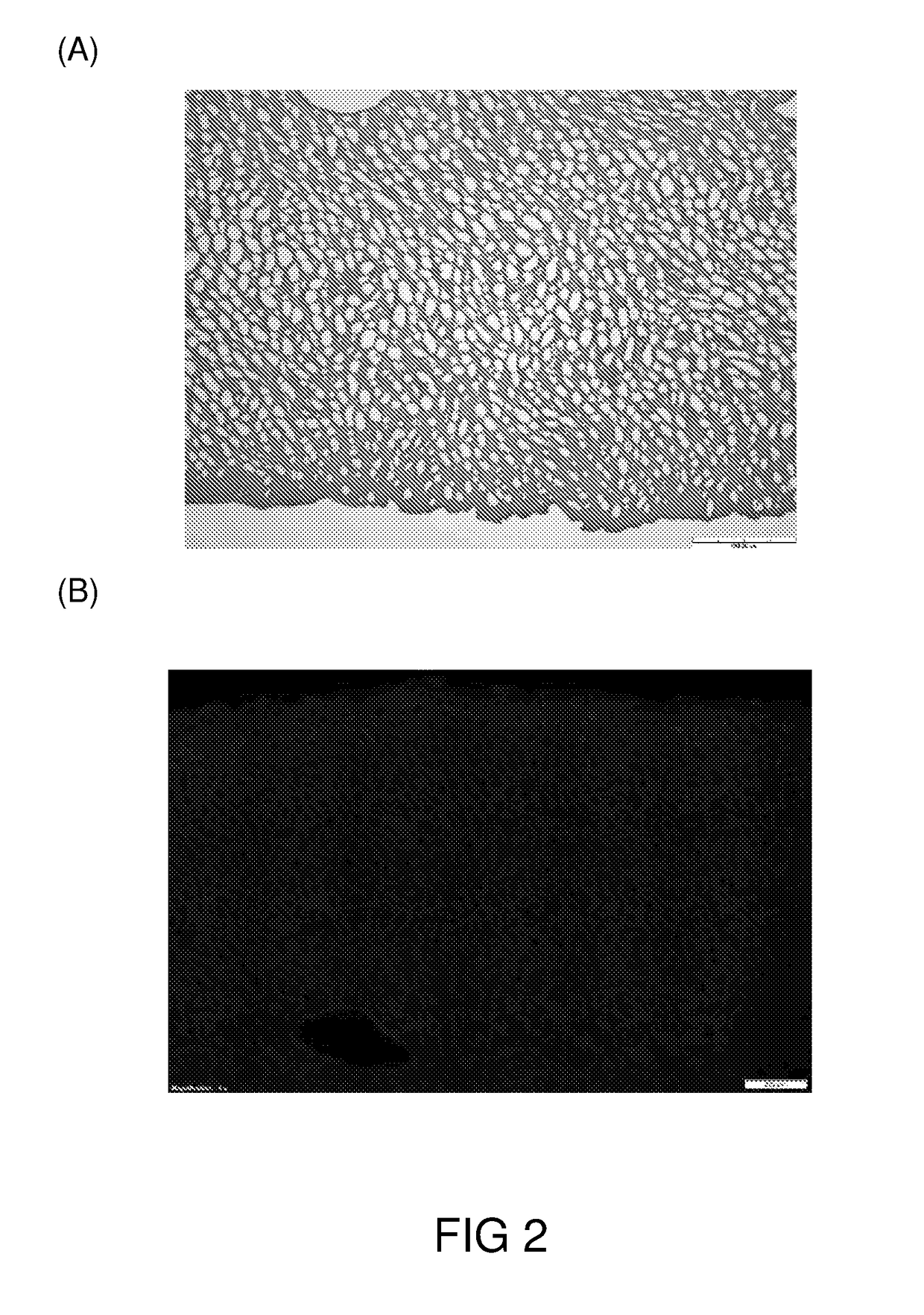 Preparation of acellular cartilage graft and uses thereof