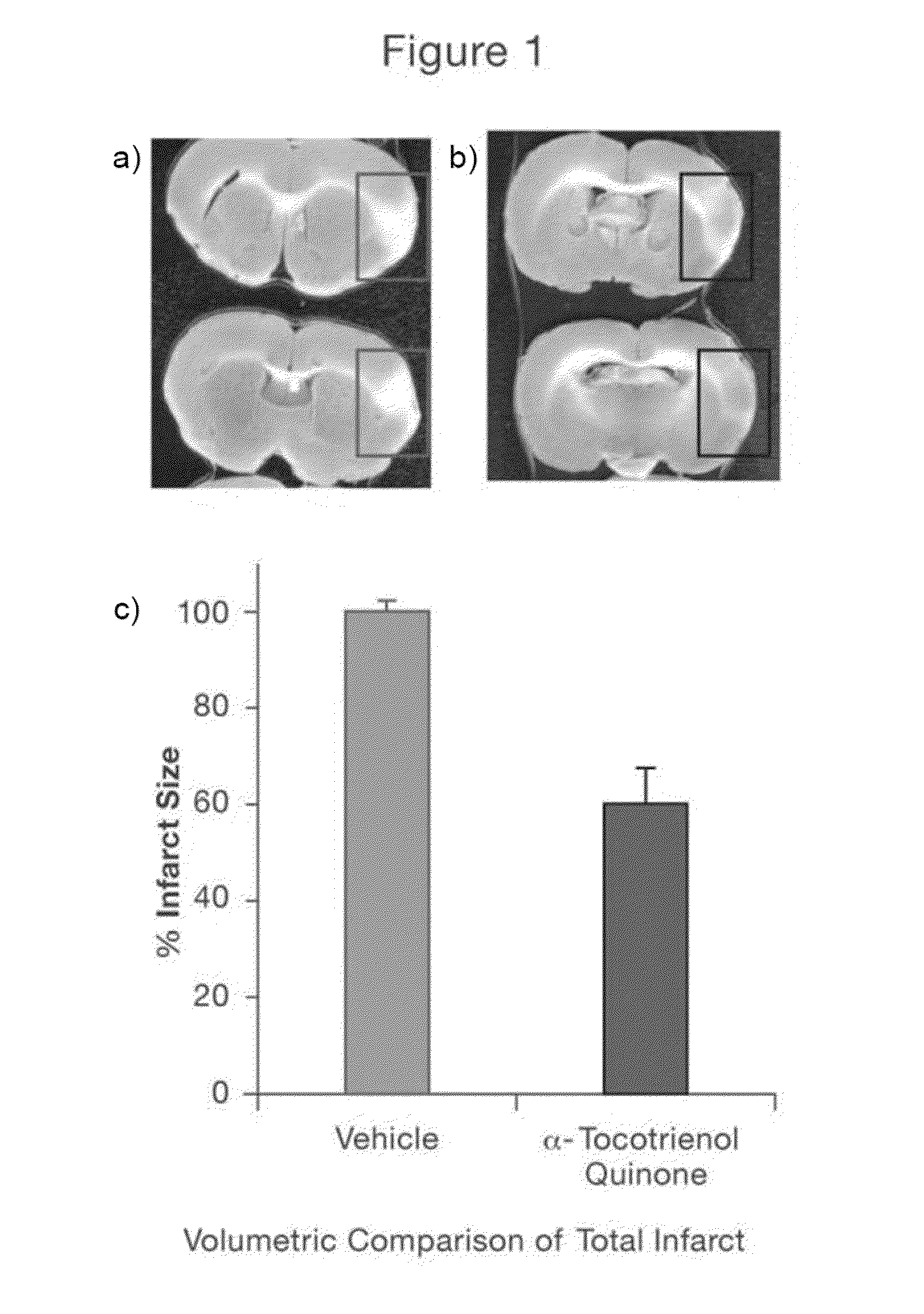 Methods for the prevention and treatment of cerebral ischemia