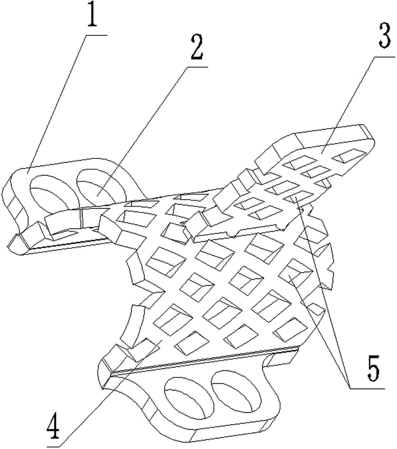 Artificial vertebral plate