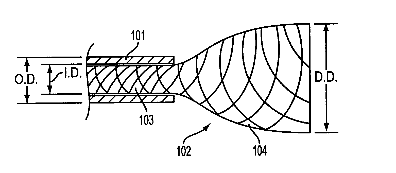 Composite stent with inner and outer stent elements and method of using the same