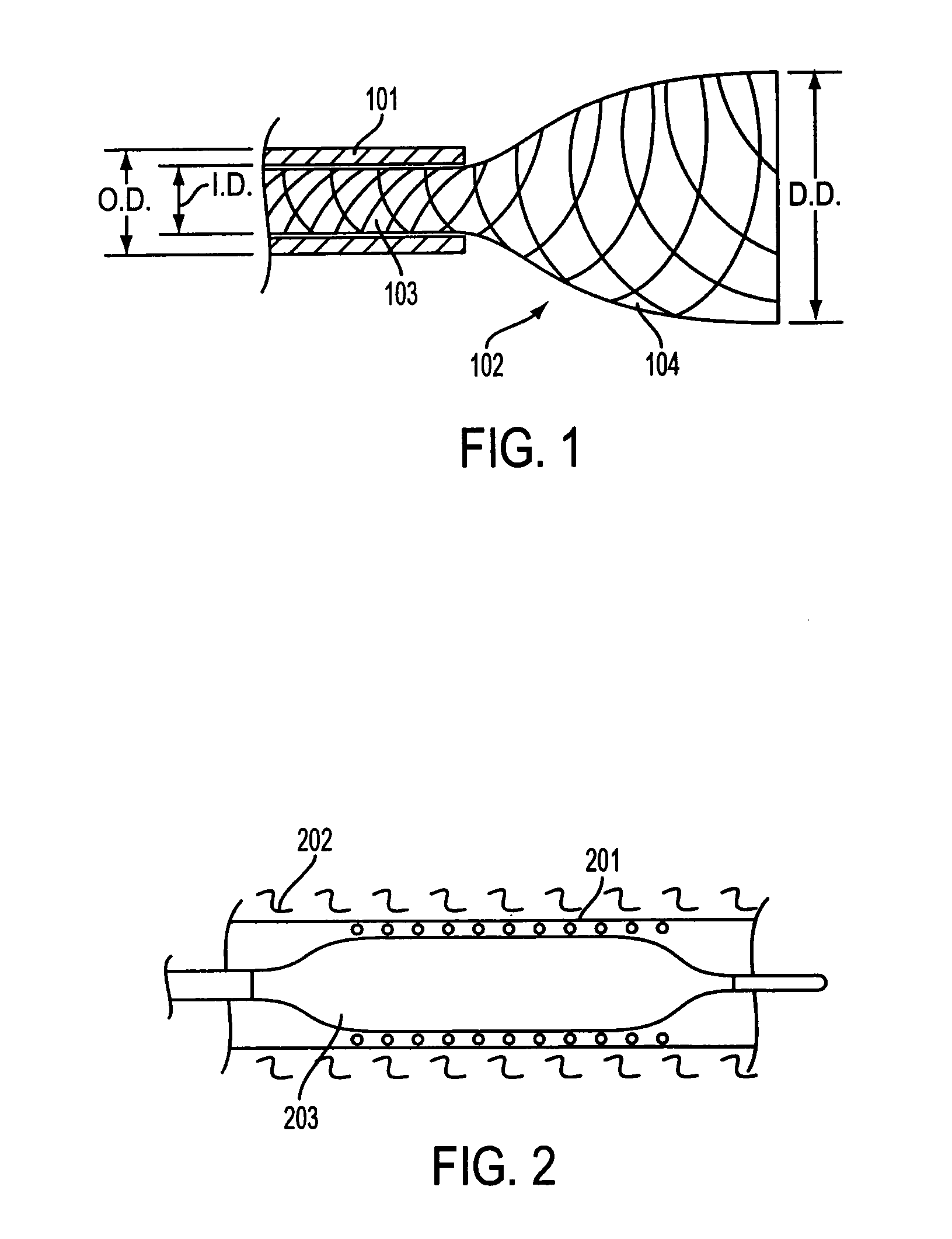 Composite stent with inner and outer stent elements and method of using the same