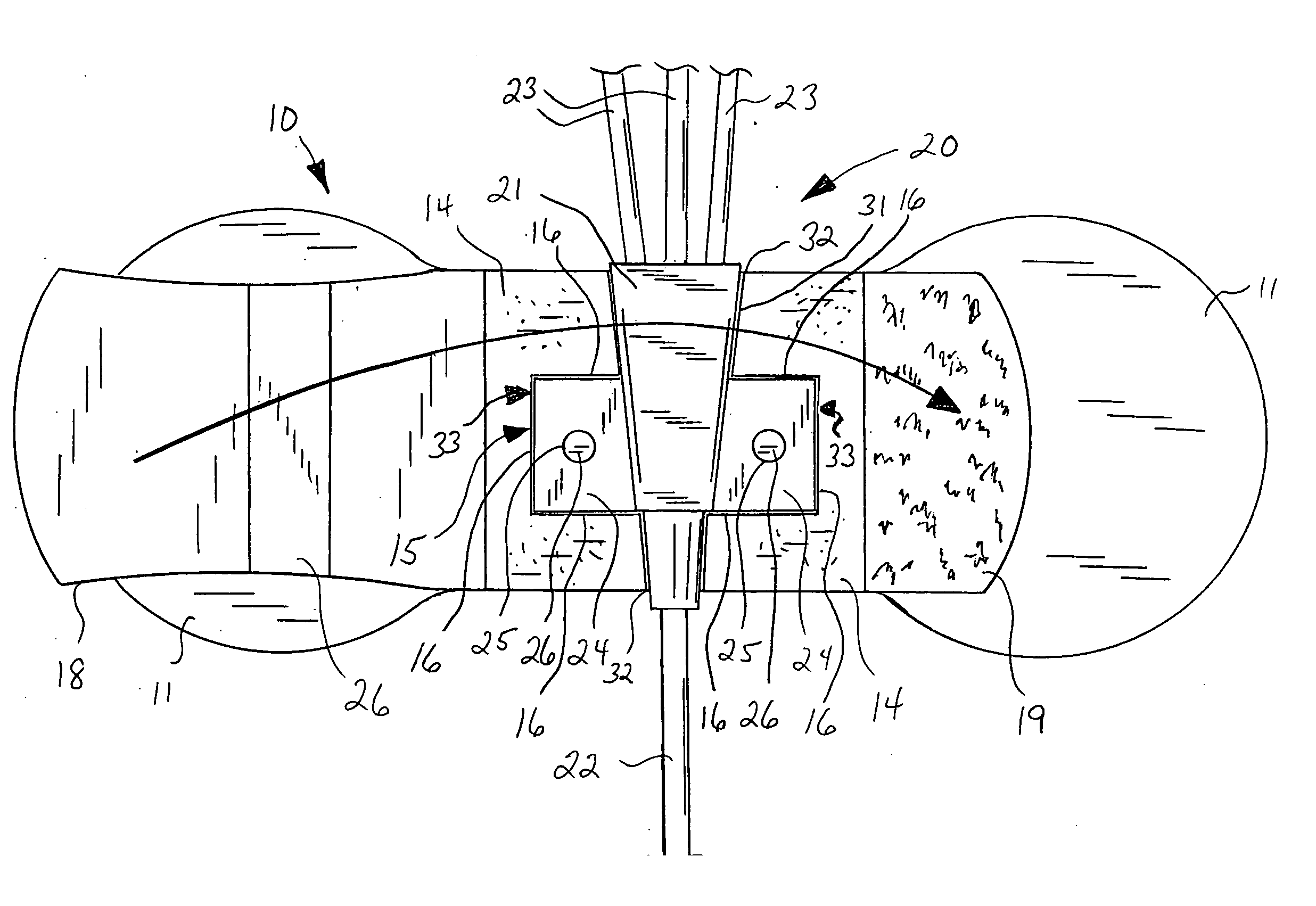 Catheter anchor