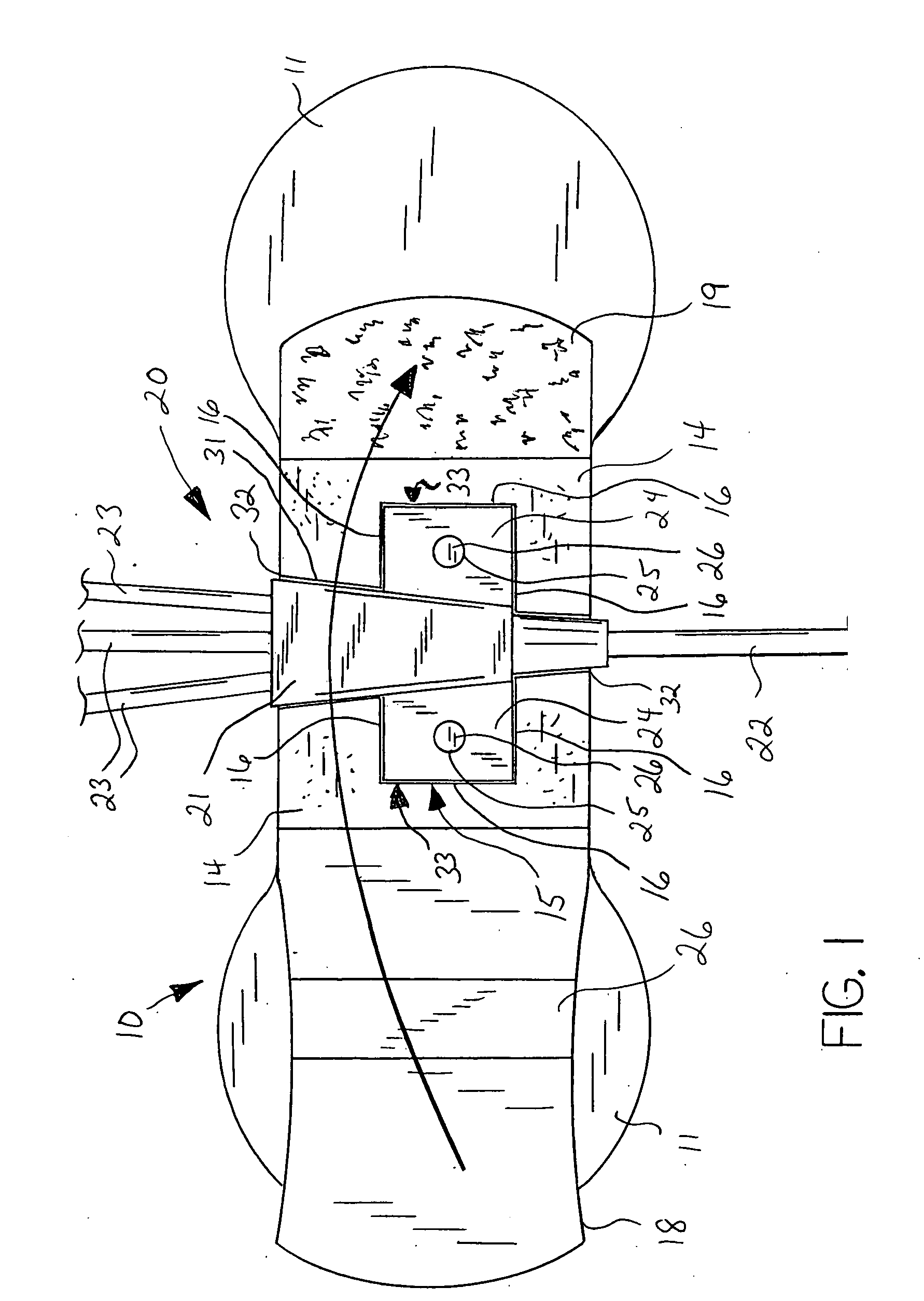 Catheter anchor