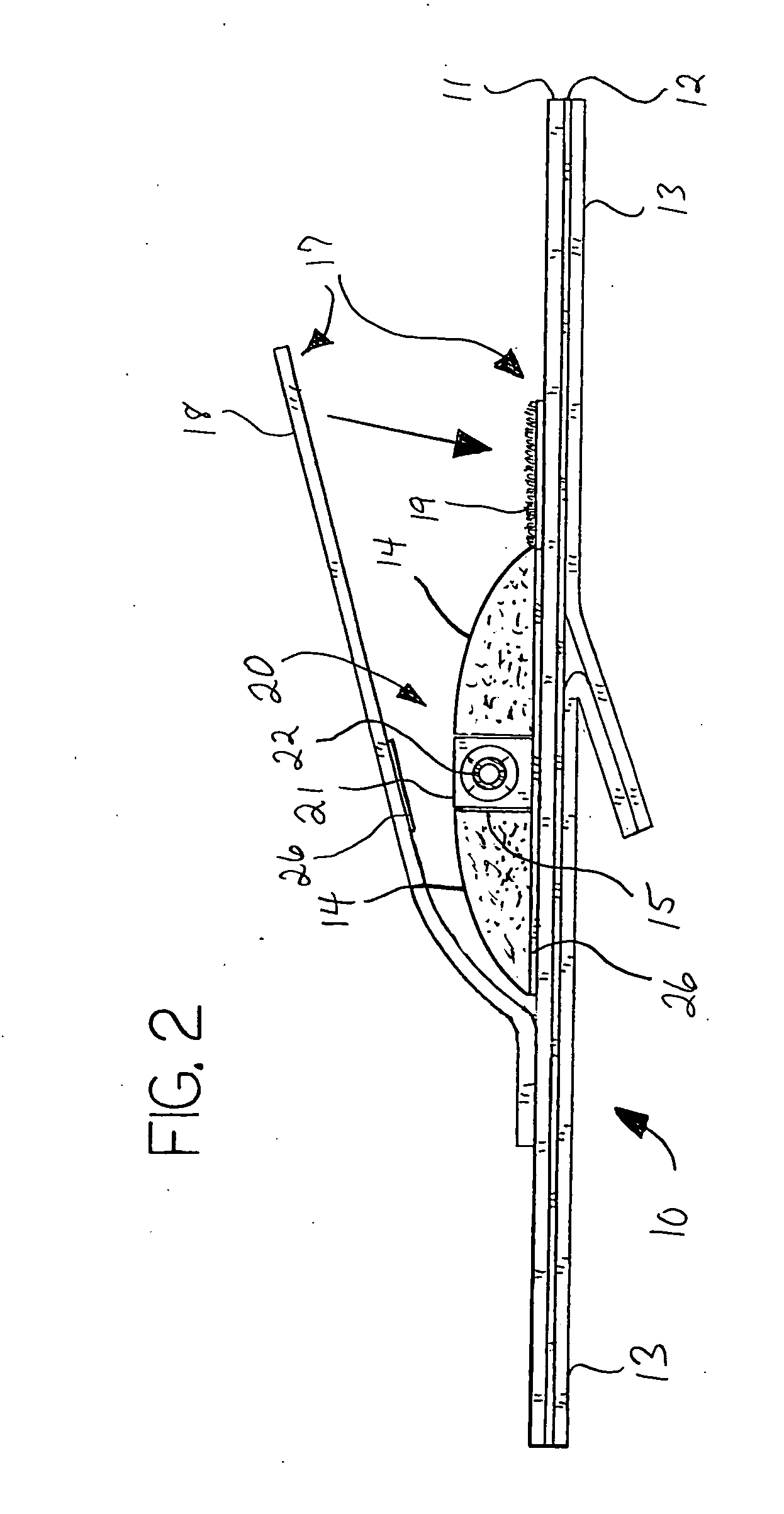 Catheter anchor