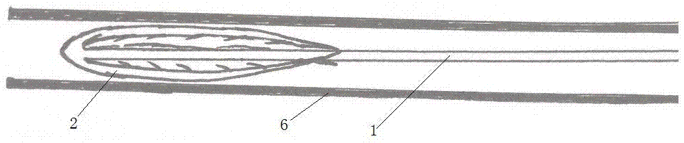 Human pathological or iatrogenic cavity blocking device