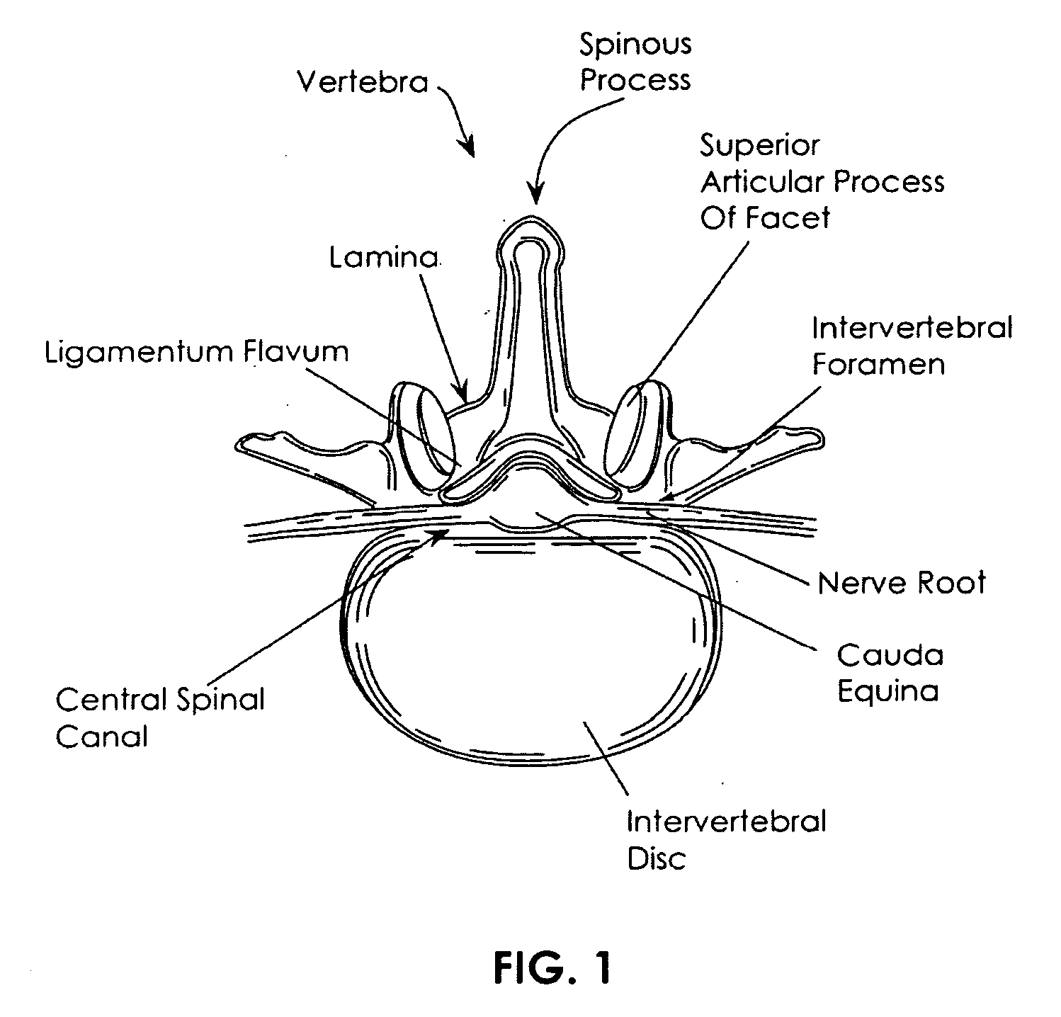 Spinal access system and method