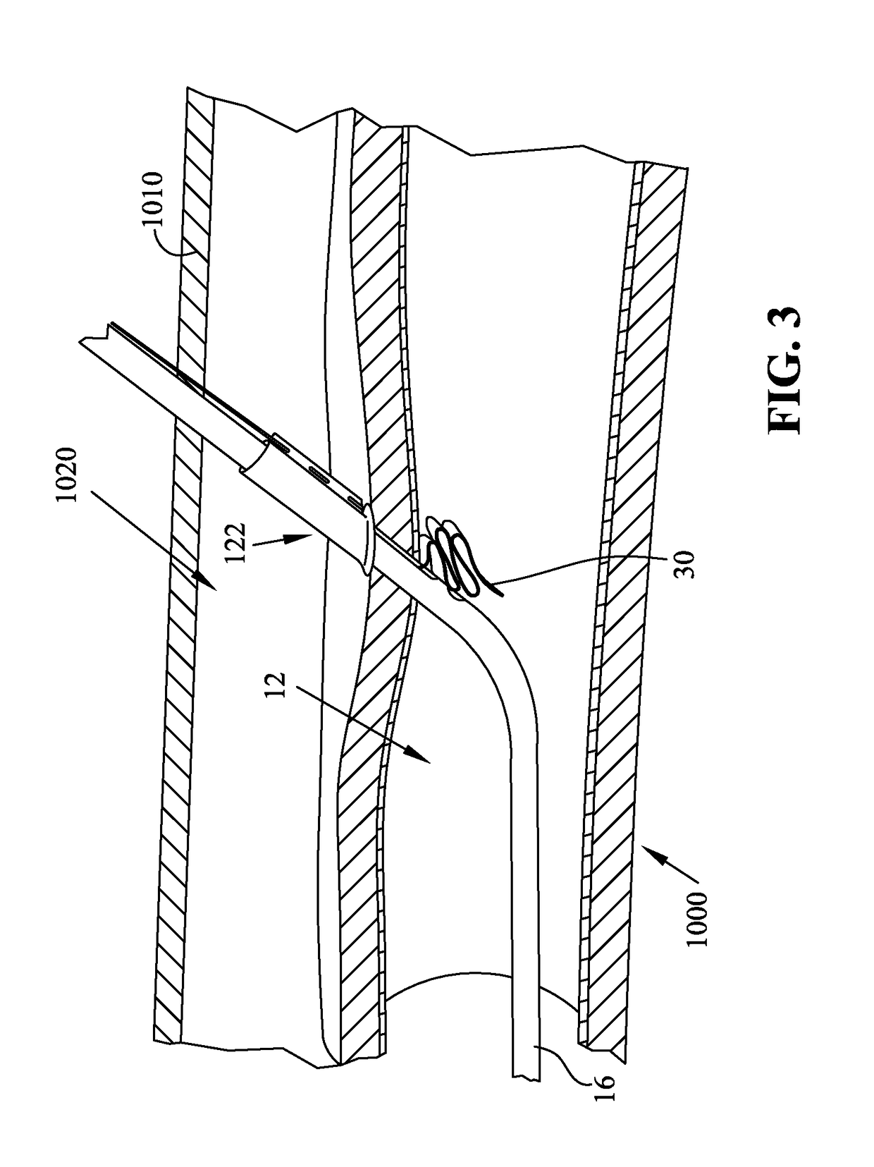 Method and apparatus for sealing access