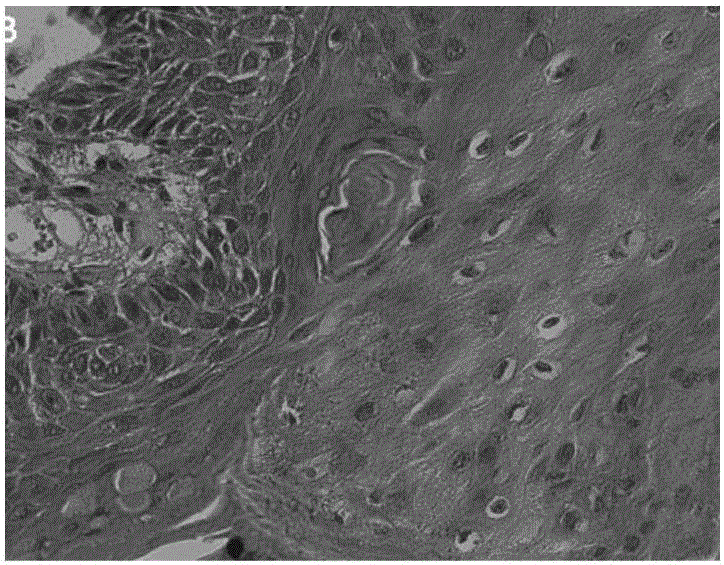 Oral squamous carcinoma cell strain as well as preparation method and applications thereof