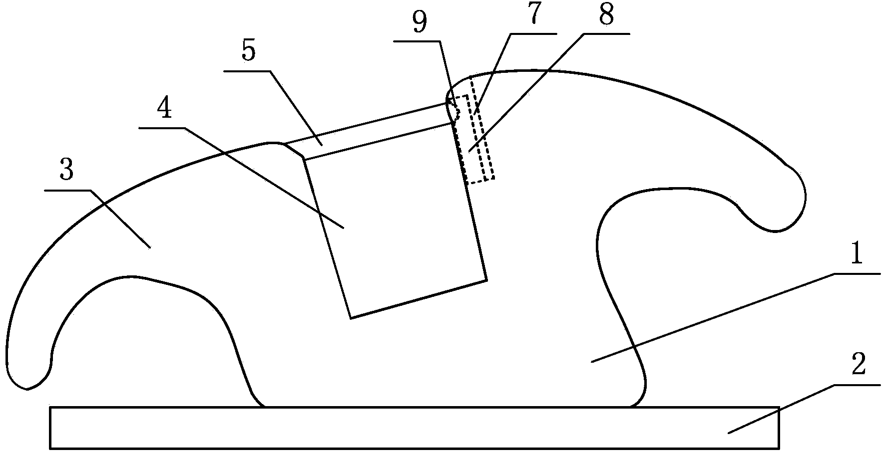 Orthodontic self-locking bracket