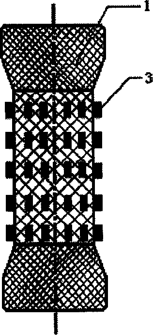 Digestive tract stent with anti-cancer medicinal particles