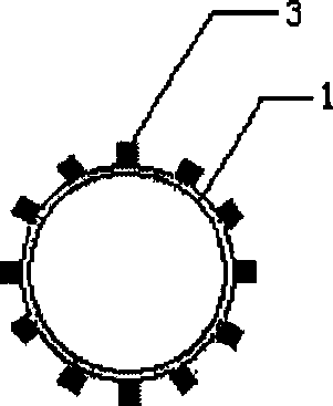 Digestive tract stent with anti-cancer medicinal particles