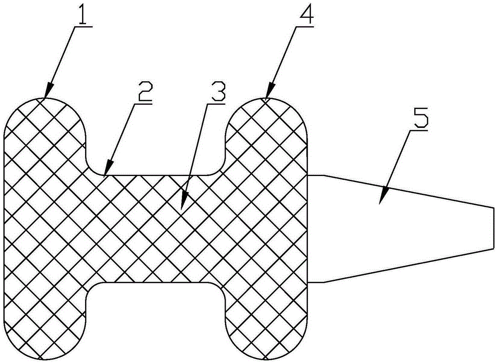 Backflow-preventing valve gastric-biliary anastomosis stent