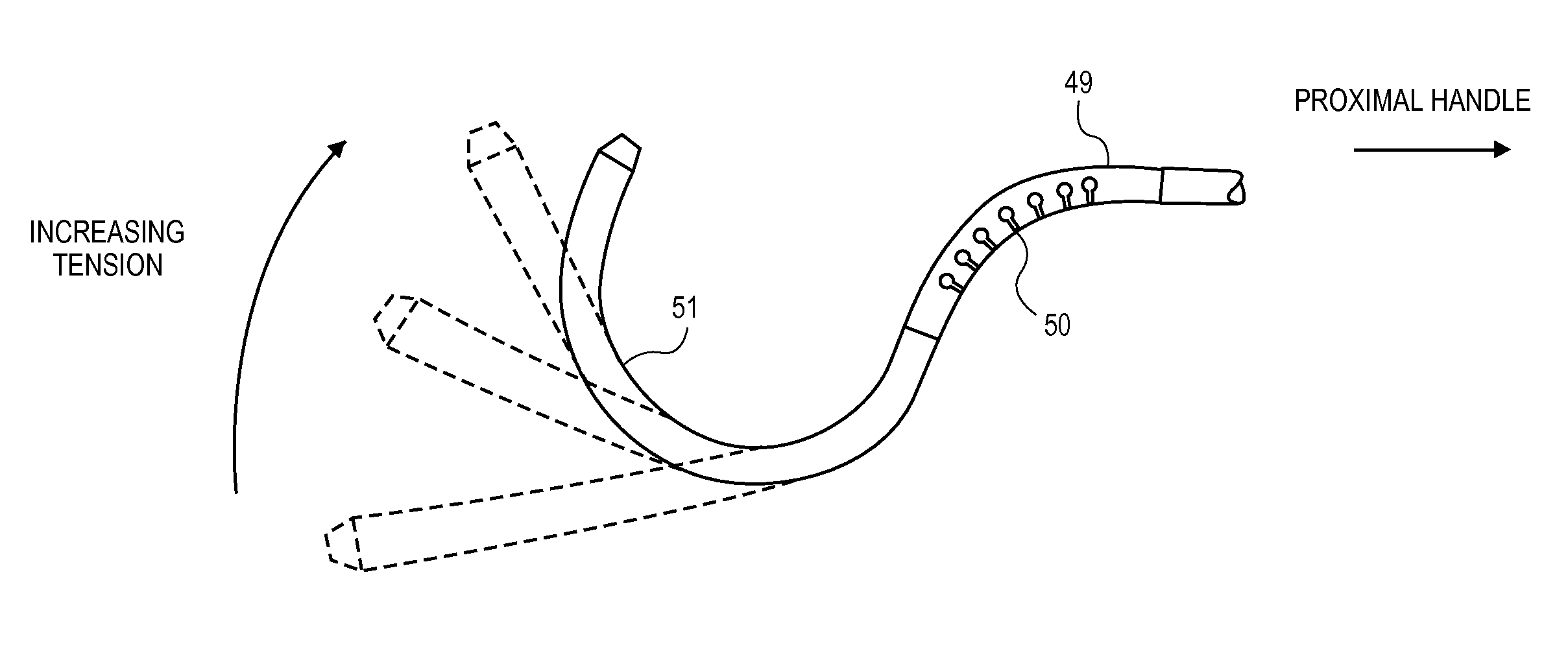 Intravascular blood filters and methods of use