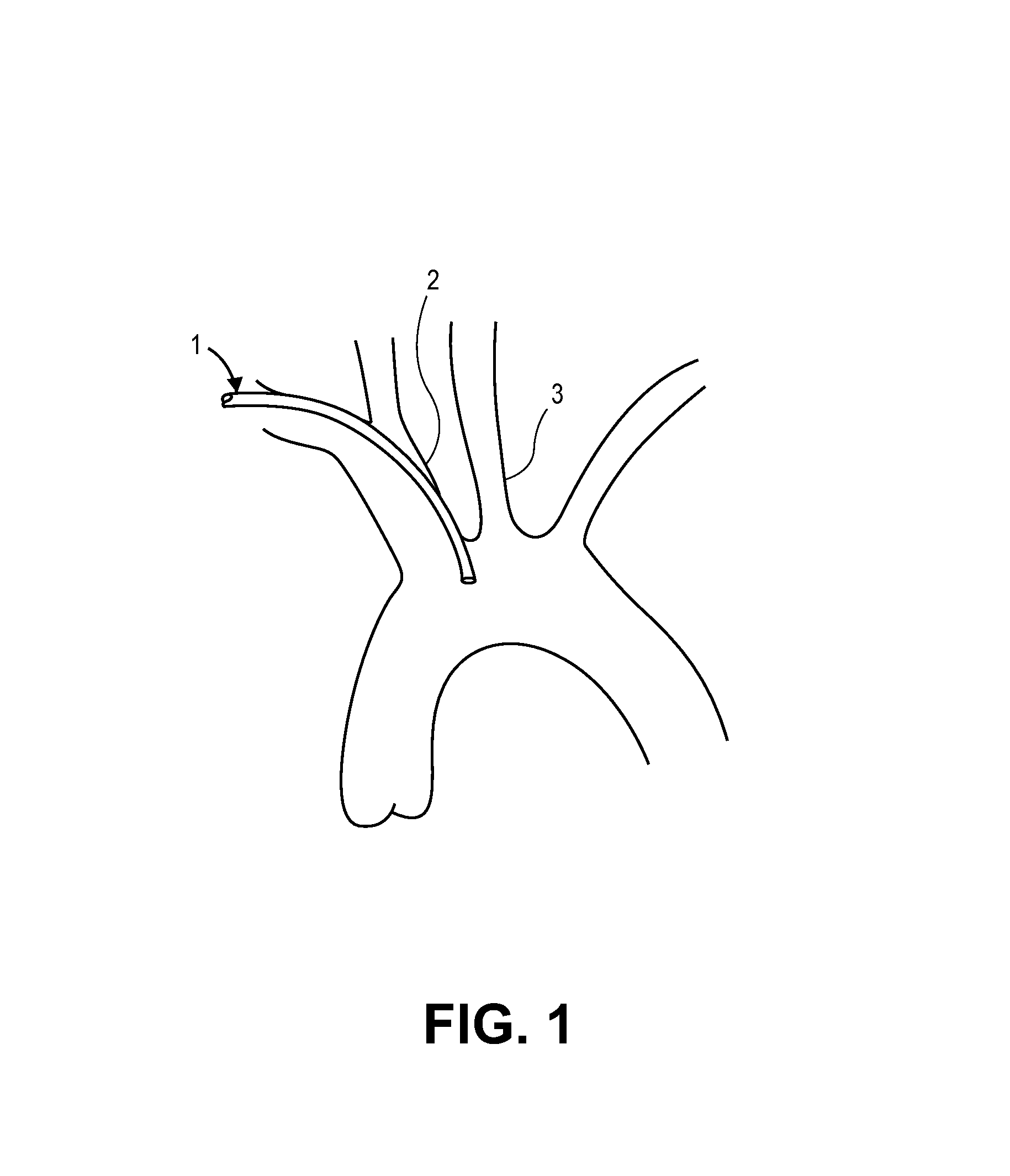 Intravascular blood filters and methods of use