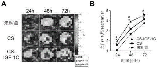 IGF-1C polypeptide combined injectable hydrogel and application thereof to carrier material to enhance repair effect of stem cells in tissue damage