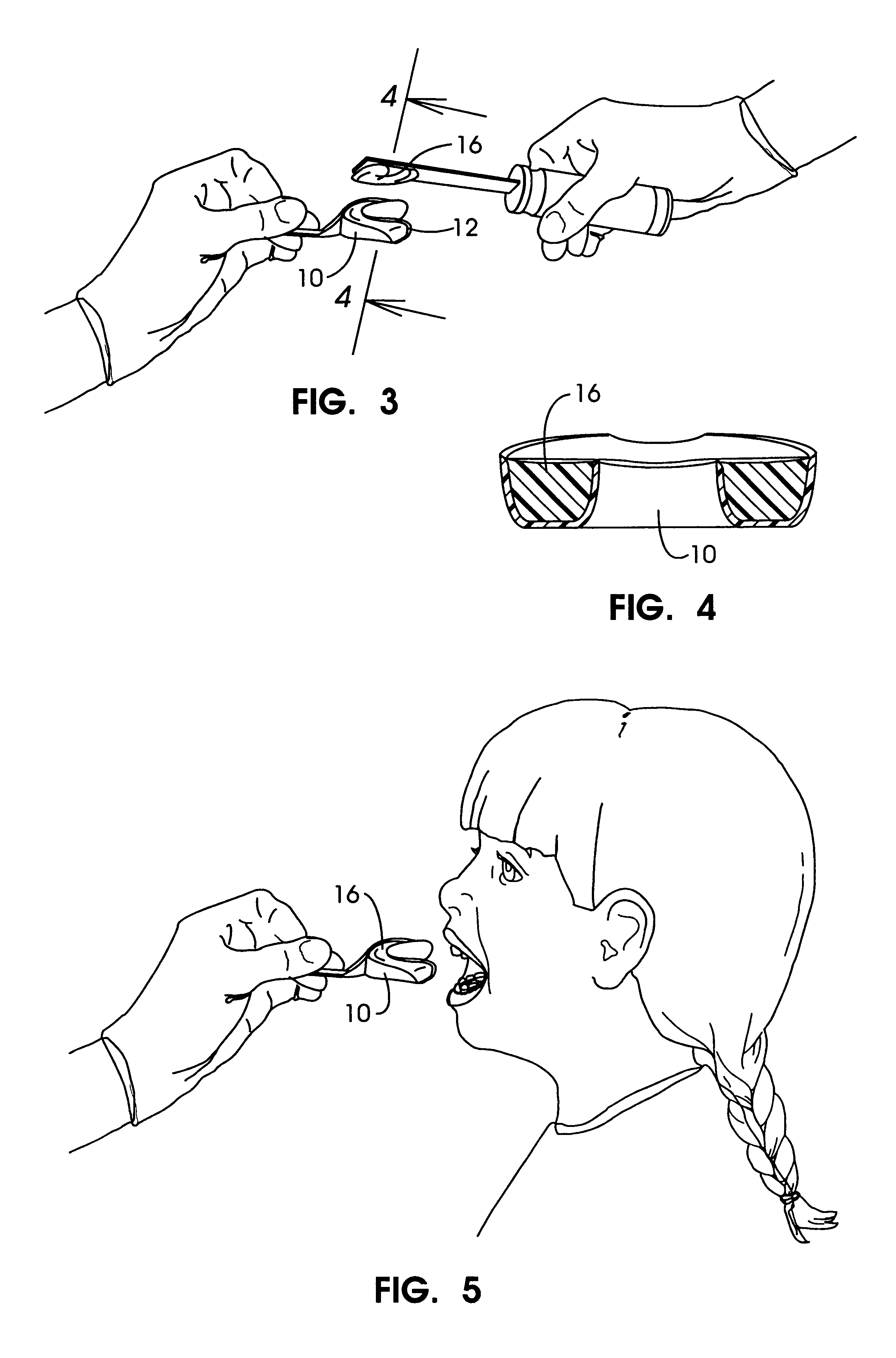 Apparatus and methods for accelerating dental treatments