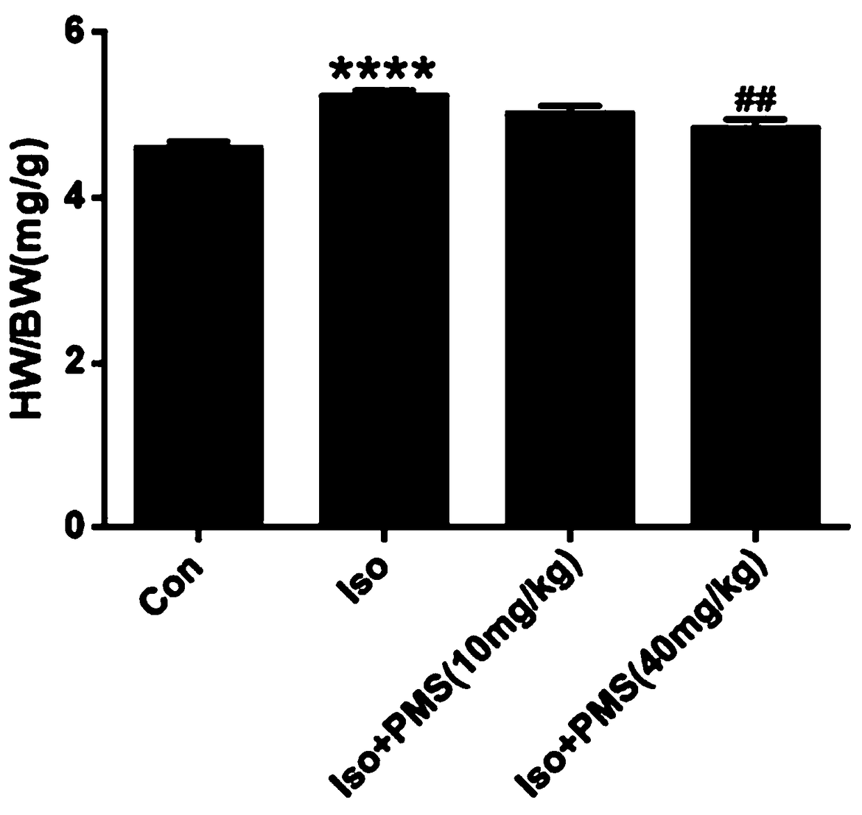 Application of plantamajoside in preparation of anti-myocardial hypertrophy drugs