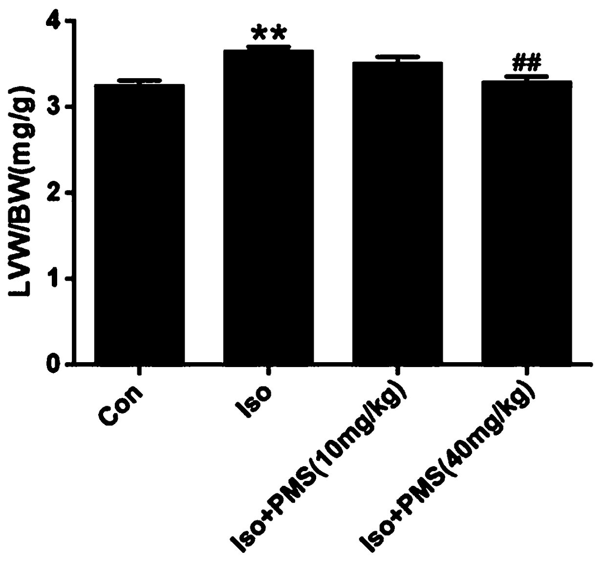 Application of plantamajoside in preparation of anti-myocardial hypertrophy drugs