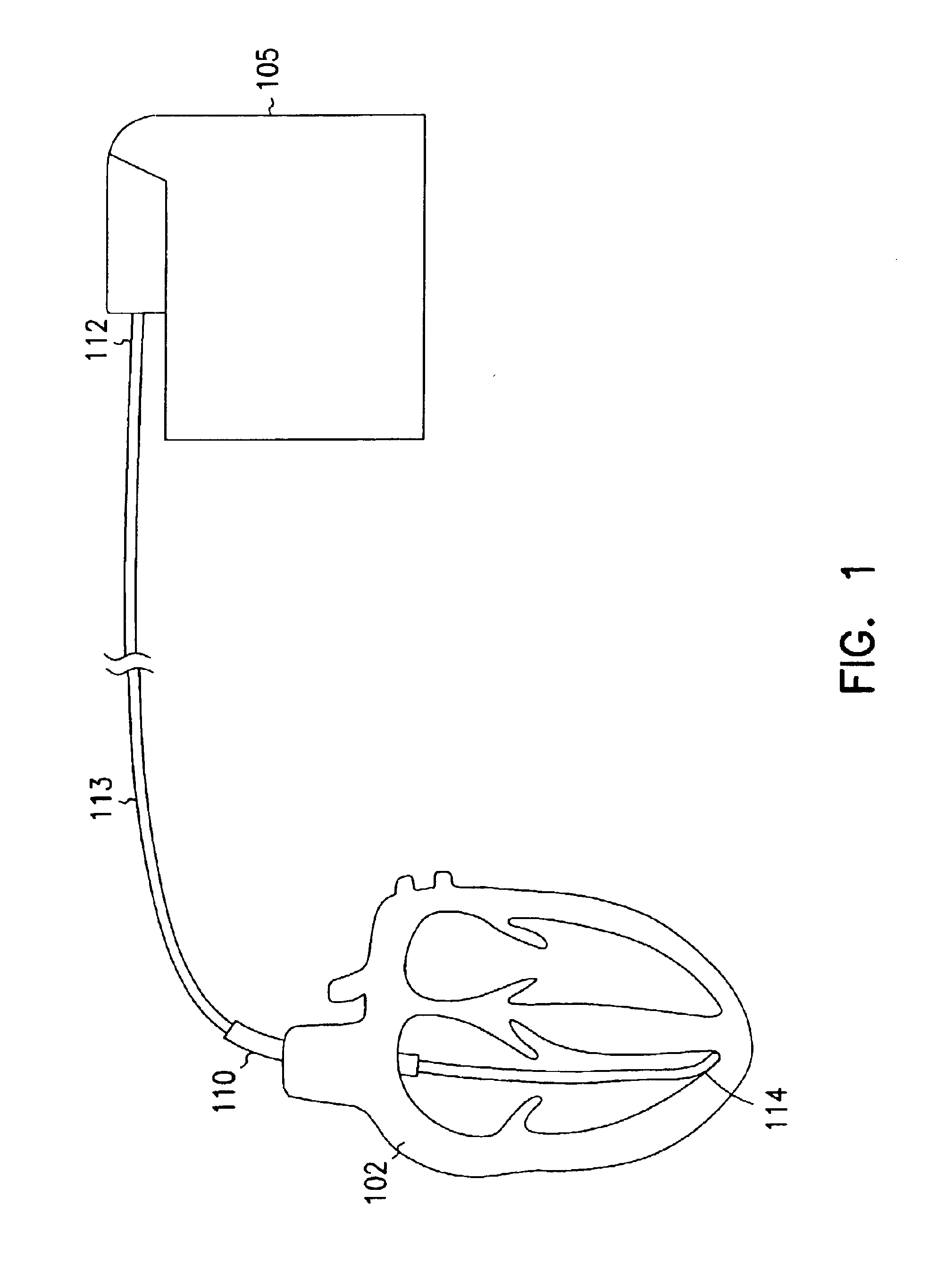 Lead with terminal connector assembly