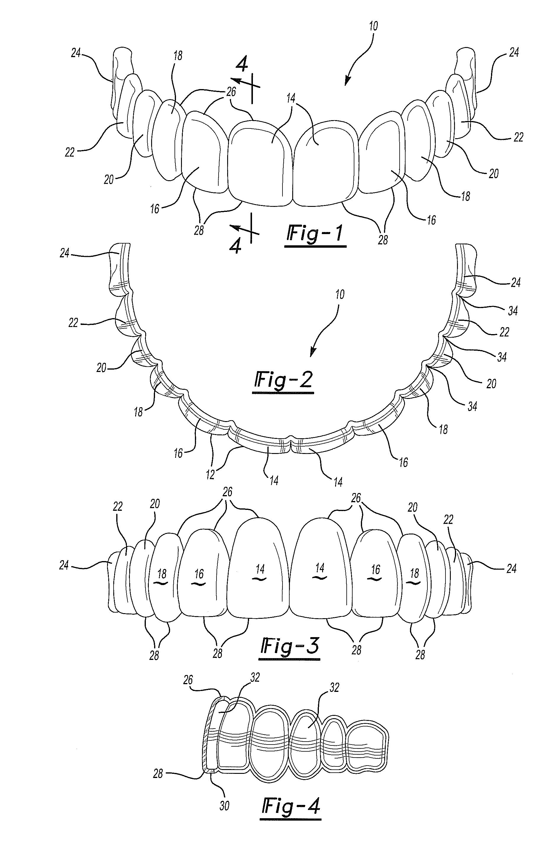 Method of using a demonstration dental template with digital representation for modeling dental restorations