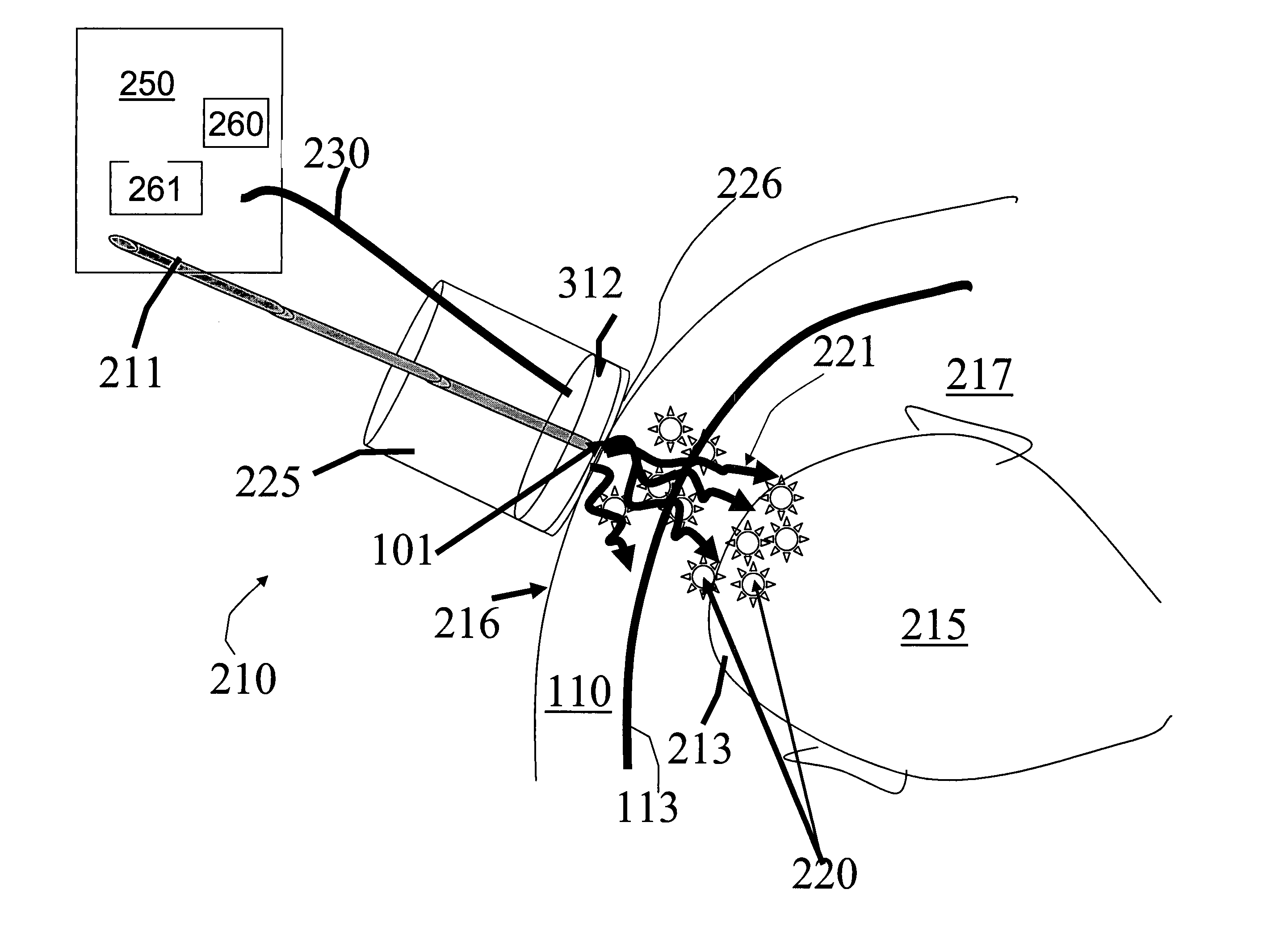 Photoacoustic analyzer of region of interest in a human body