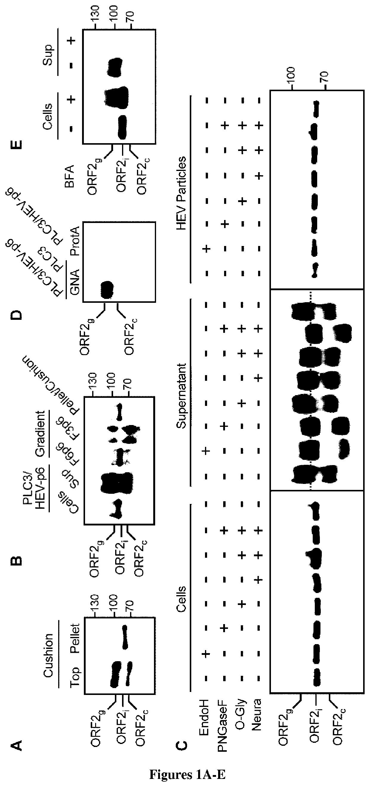 Hepatitis e virus orf2 capsid polypeptides and uses thereof