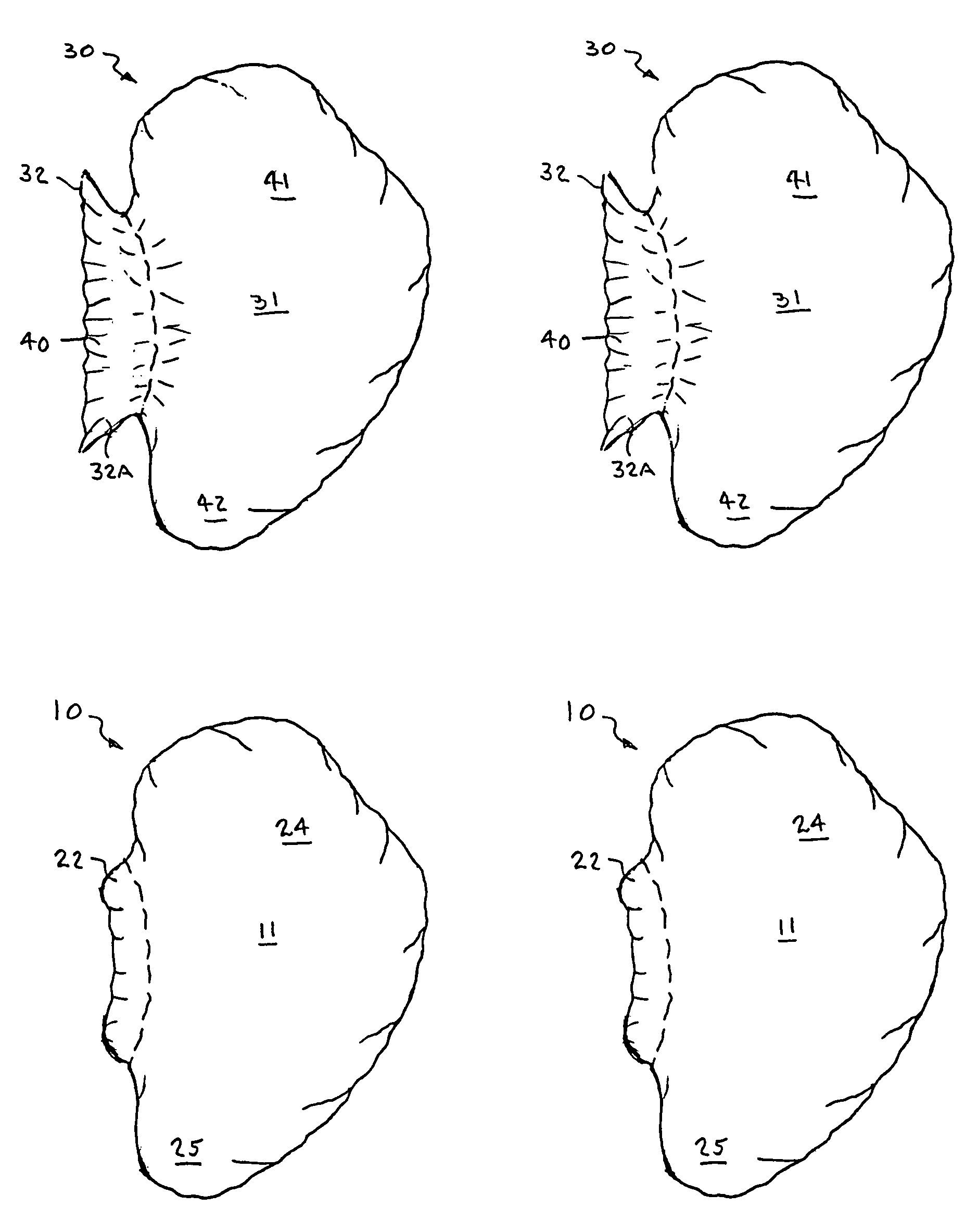 Ear protectors and method of manufacture thereof