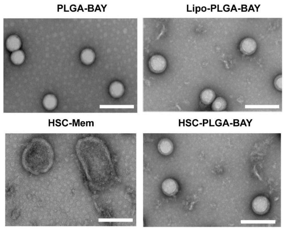 Preparation method and application of bionic nano-drug targeting hepatic stellate cells