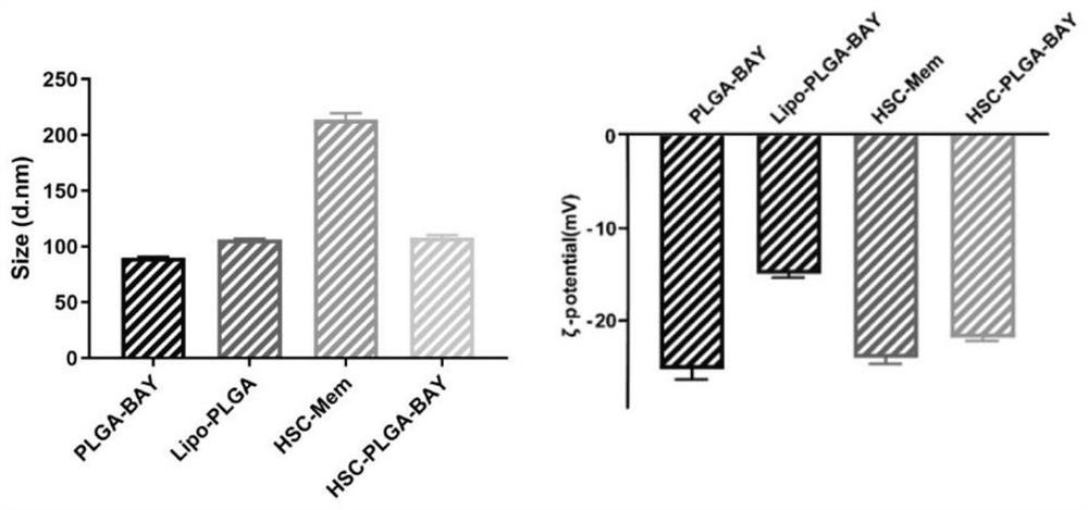 Preparation method and application of bionic nano-drug targeting hepatic stellate cells