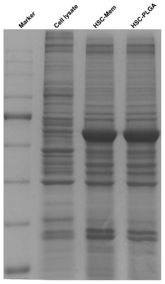 Preparation method and application of bionic nano-drug targeting hepatic stellate cells