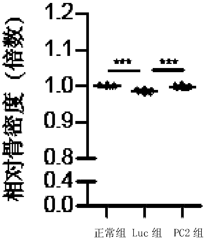 Application of PC2 gene or recombinant virus expressing PC2 gene to preparation of medicament for treating osteoarthritis