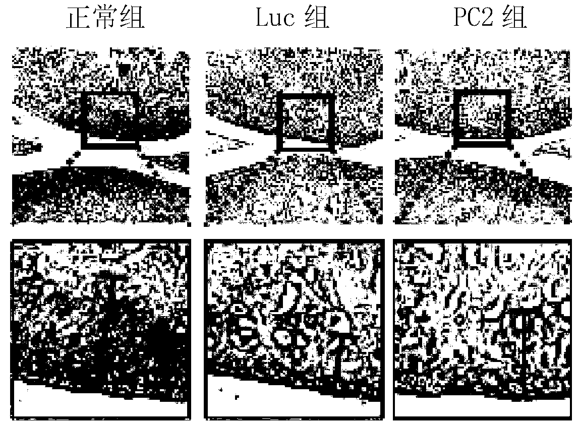 Application of PC2 gene or recombinant virus expressing PC2 gene to preparation of medicament for treating osteoarthritis