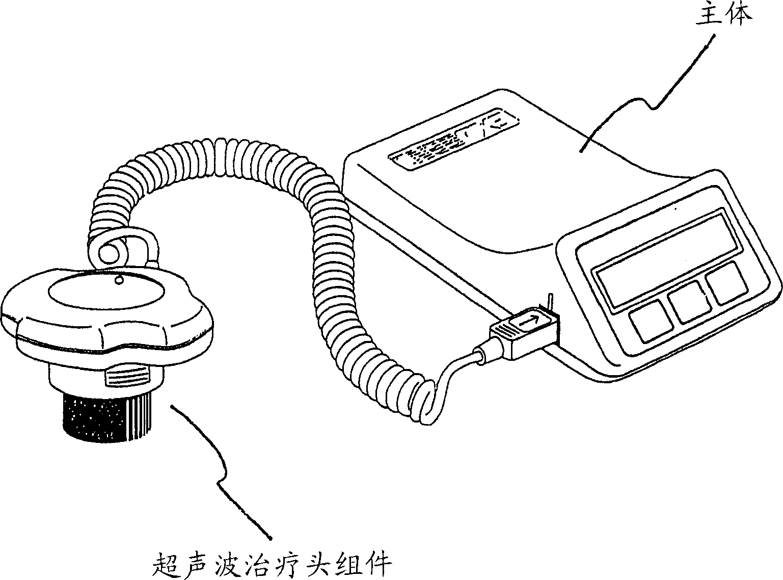 Method of treating osteochondritis and apparatus for treating osteochondritis