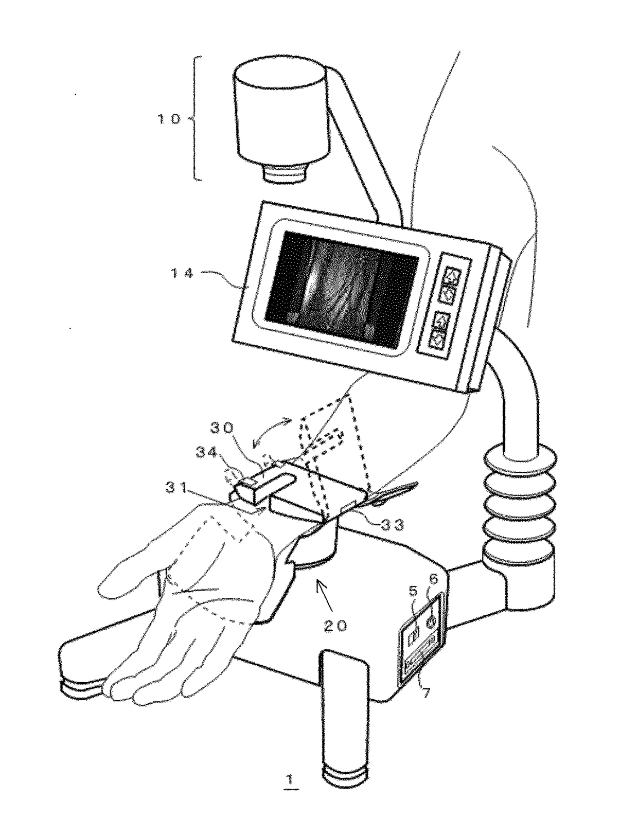 Artery visualization device