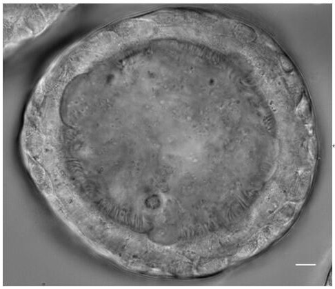 Standardized culture medium and culture method for three-dimensional culture of lung and lung cancer tissue organoids