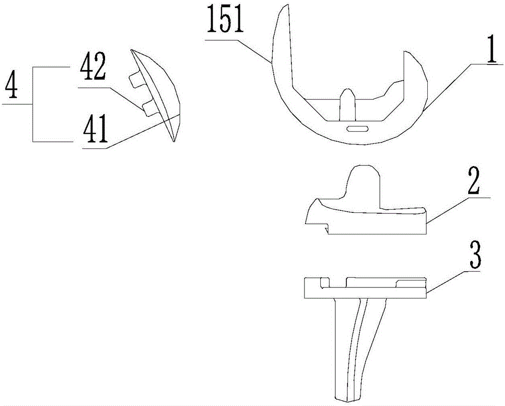 Total-knee-joint replacement prosthesis