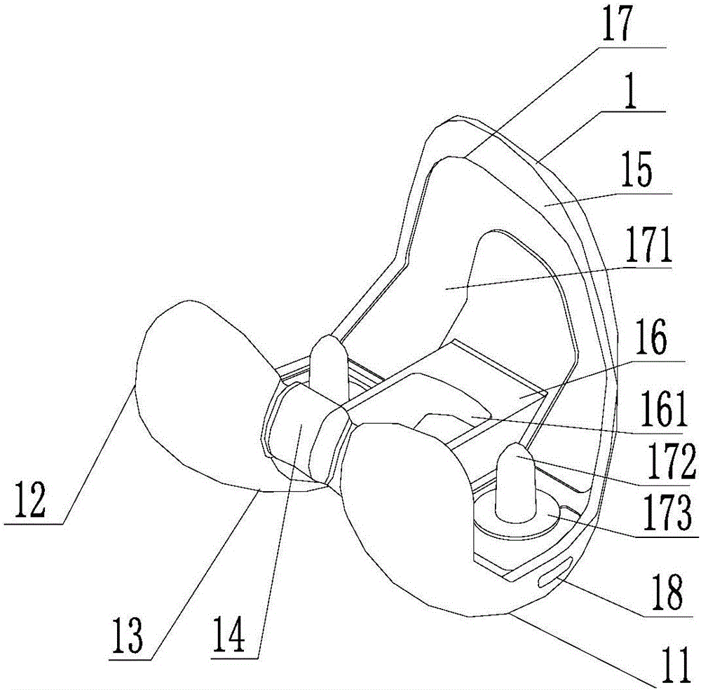 Total-knee-joint replacement prosthesis