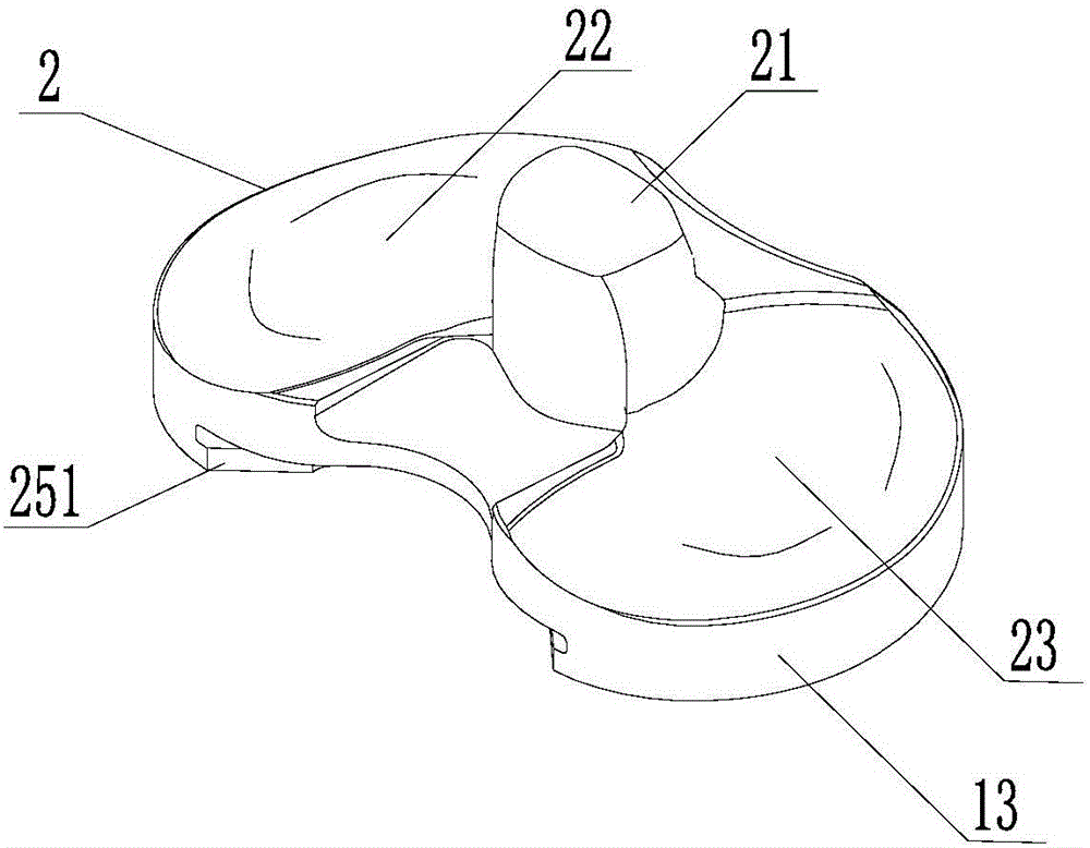 Total-knee-joint replacement prosthesis