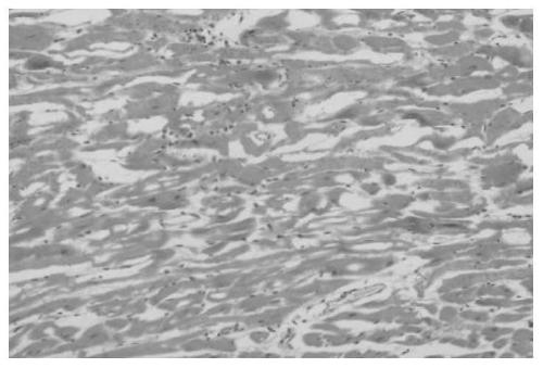 Traditional Chinese medicine composition for treating stroke, middle meridian, coronary heart disease and angina pectoris caused by obstruction of collaterals by blood stasis and preparation method of traditional Chinese medicine composition