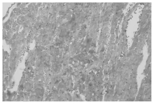 Traditional Chinese medicine composition for treating stroke, middle meridian, coronary heart disease and angina pectoris caused by obstruction of collaterals by blood stasis and preparation method of traditional Chinese medicine composition