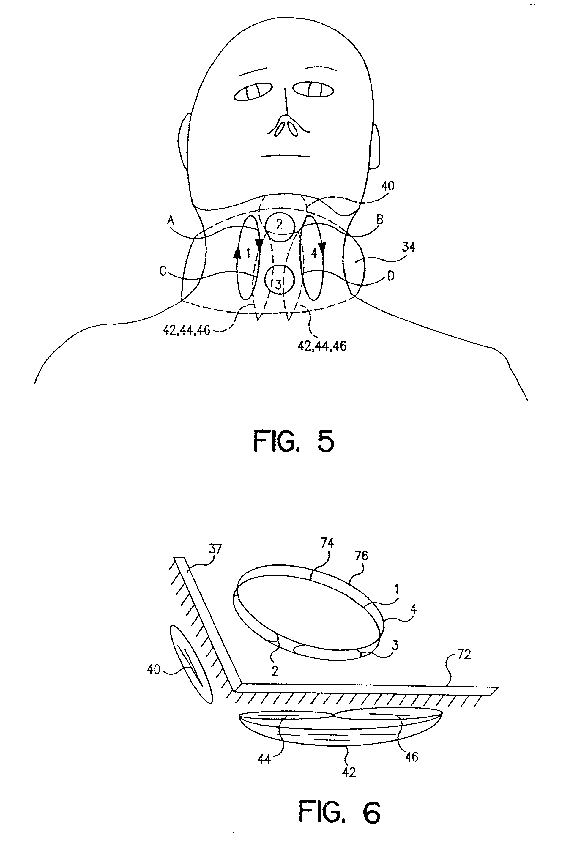 Muscle stimulating device and method for diagnosing and treating a breathing disorder