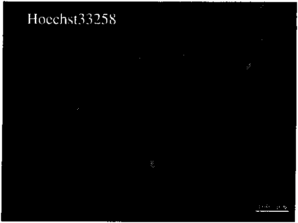 Method for inducing and differentiating into dopaminergic neuron from human amniotic sepithelial cell and application for separating obtained dopaminergic neuron