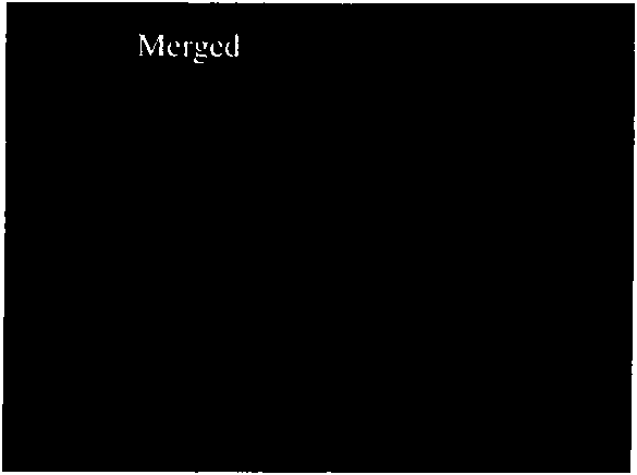 Method for inducing and differentiating into dopaminergic neuron from human amniotic sepithelial cell and application for separating obtained dopaminergic neuron