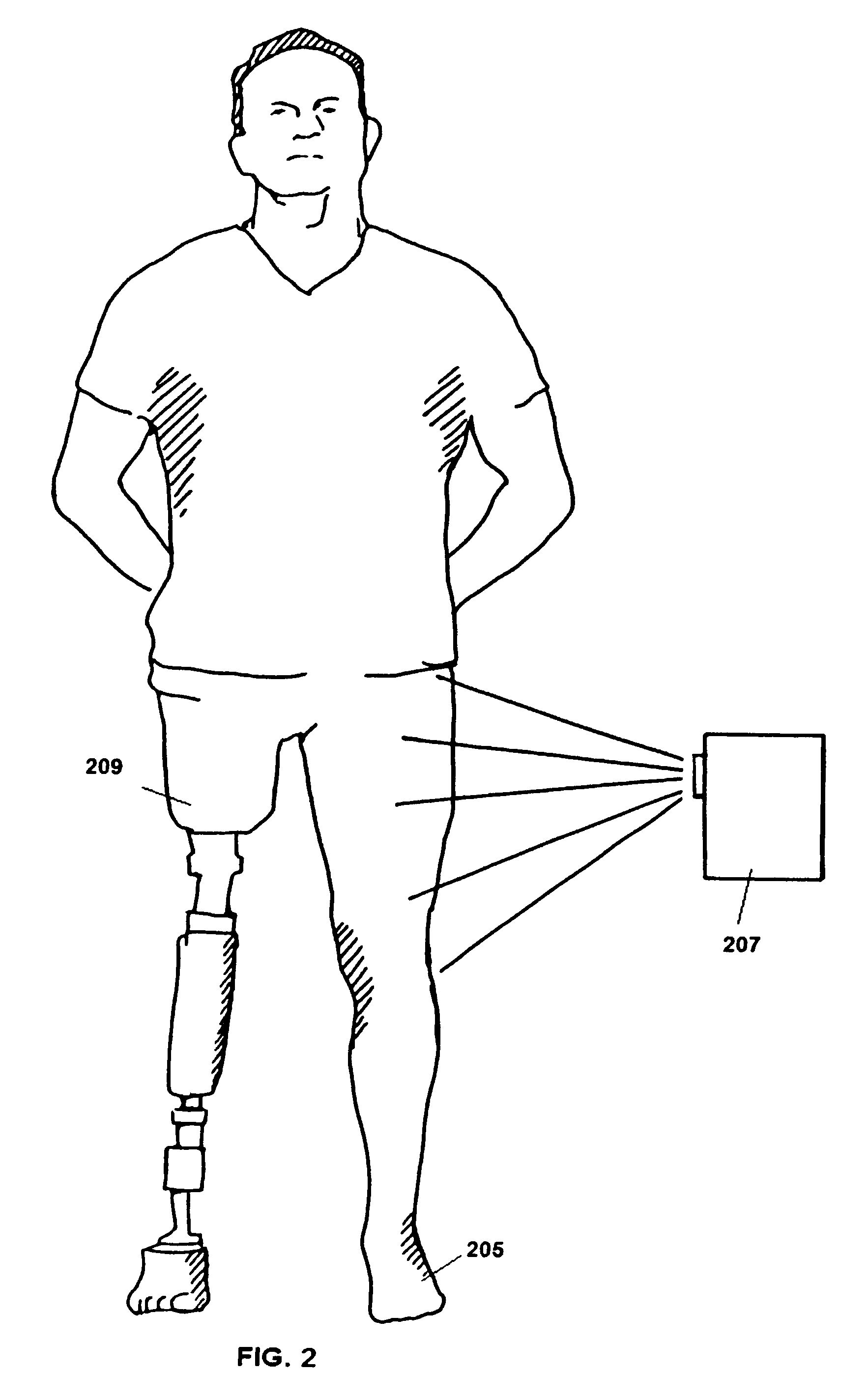 Prosthetic limb with replaceable fairing