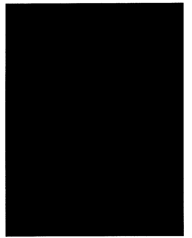 Self-adaptive pre-segmentation method based on gray scale and gradient of image and gray scale statistic histogram