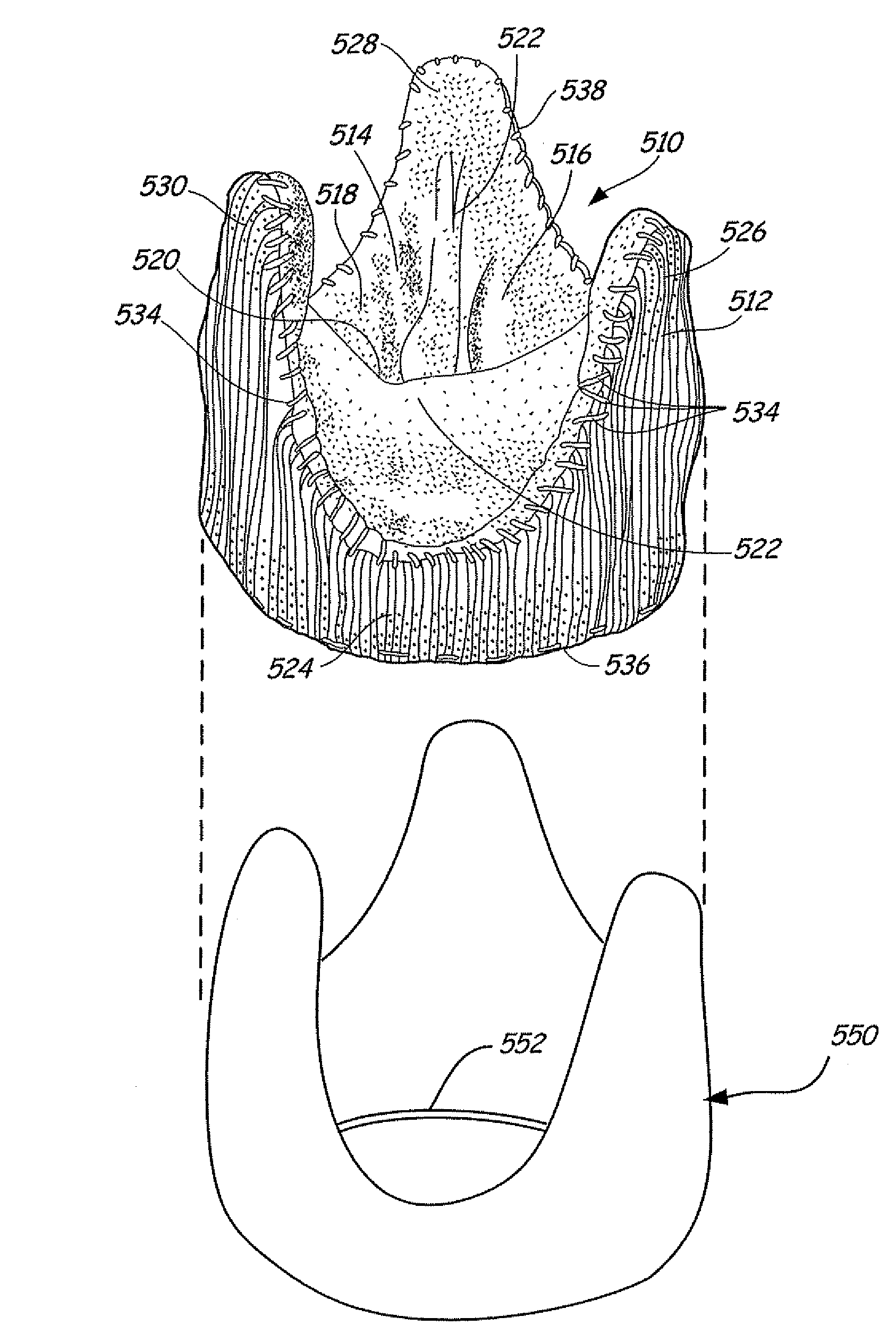 Two piece bioprosthetic heart valve with matching outer frame and inner valve