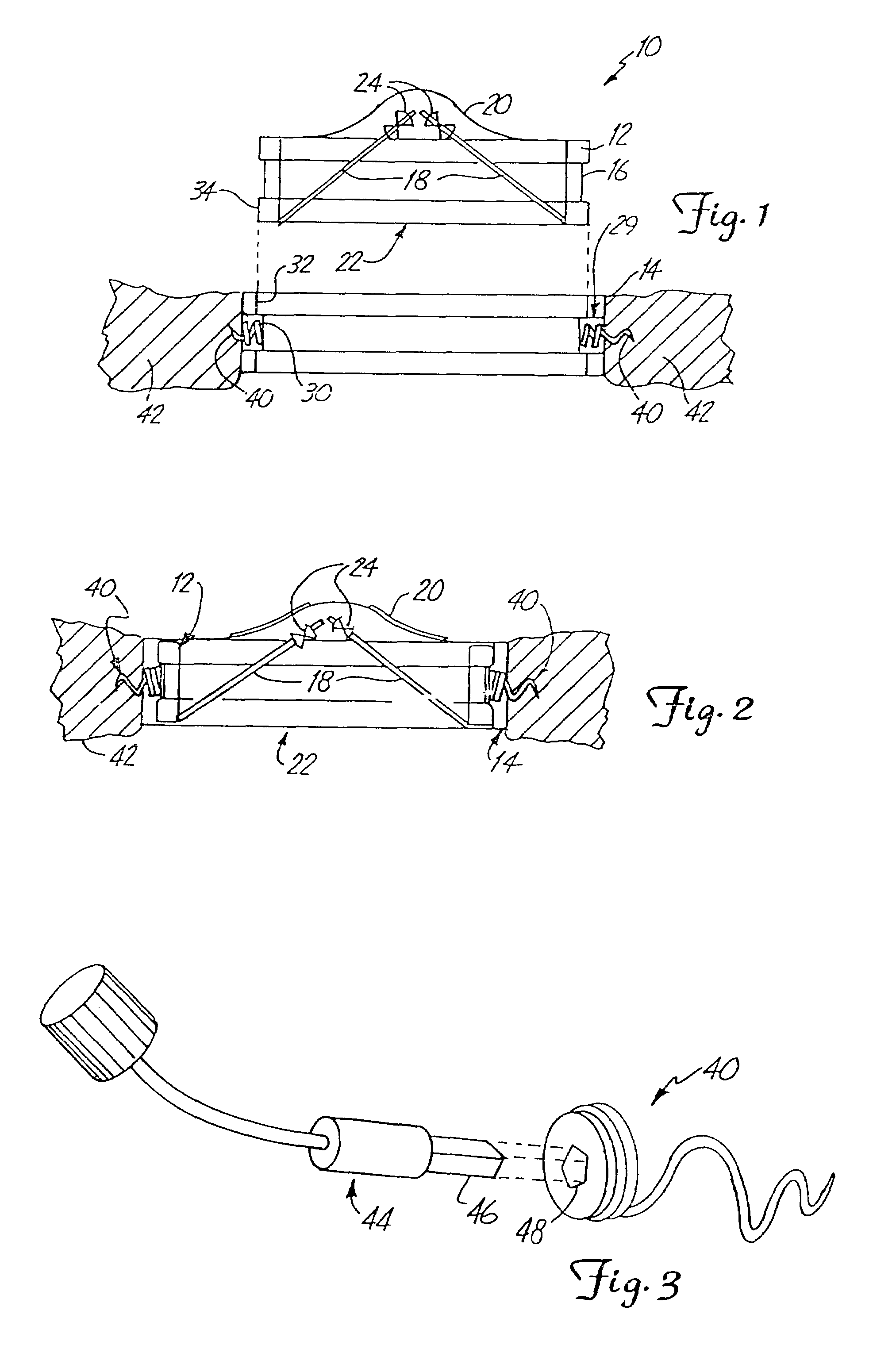 Two piece bioprosthetic heart valve with matching outer frame and inner valve